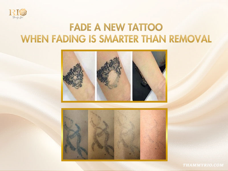 Steps to fade a tattoo showing before and after results for ink lightening.