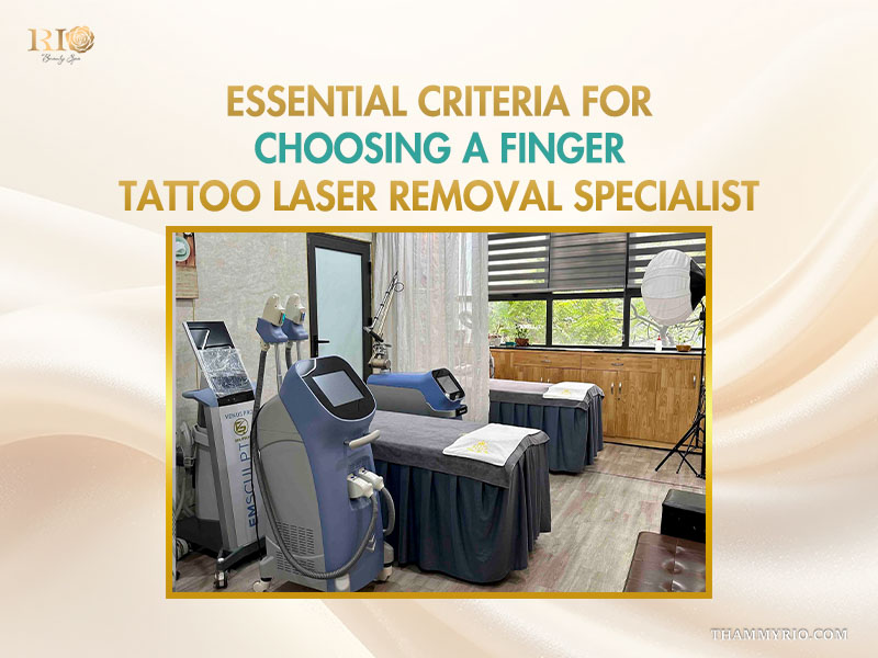 Professional laser equipment for finger tattoo removal in a modern clinic setting.