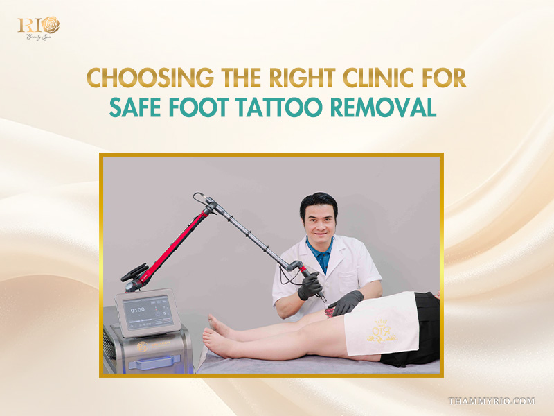 Professional specialist performing safe foot tattoo removal at Rio Beauty Spa.