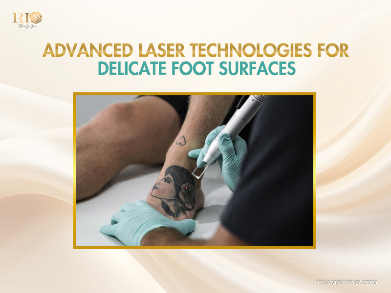 Professional laser foot tattoo removal treatment at Rio Beauty Spa.