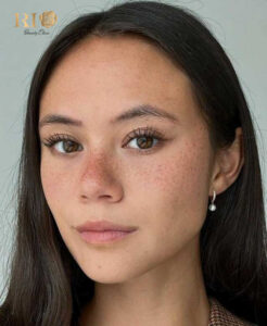 Unique and customized freckle tattoo designs for personal style at Rio Beauty Clinic