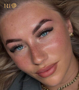 A cute, sweet, and sun-kissed look with Freckle Tattoo Rio Beauty Clinic for a youthful appearance