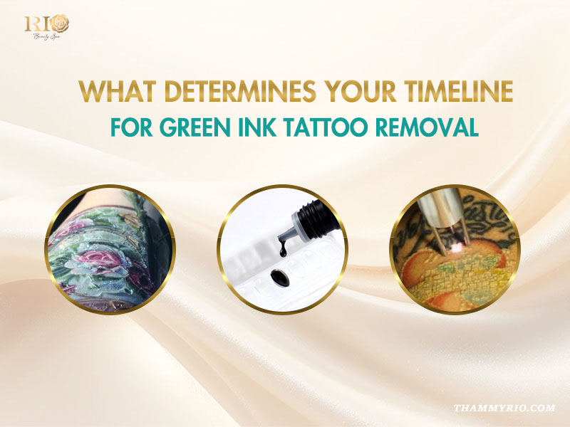 Infographic explaining factors affecting the timeline for green ink tattoo removal including ink density and laser technology.