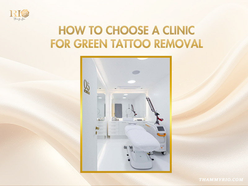 Modern laser treatment room equipped with advanced technology for green ink tattoo removal.