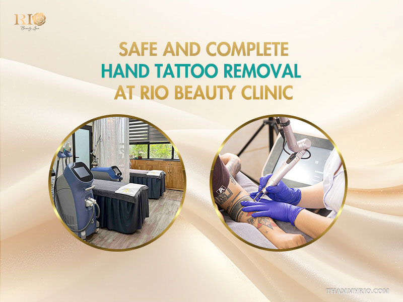 Before and after hand tattoo removal showing a large rose and HOPE finger letters fading.