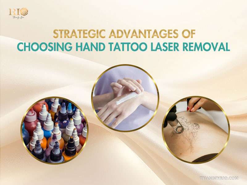 Infographic showing strategic advantages of choosing hand tattoo laser removal with images of ink bottles and skin care.