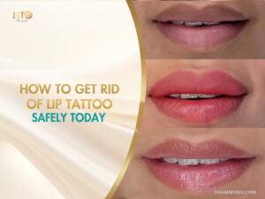 A professional infographic from Rio Beauty Spa showing the steps of how to get rid of lip tattoo safely today with three stages of lip transformation.