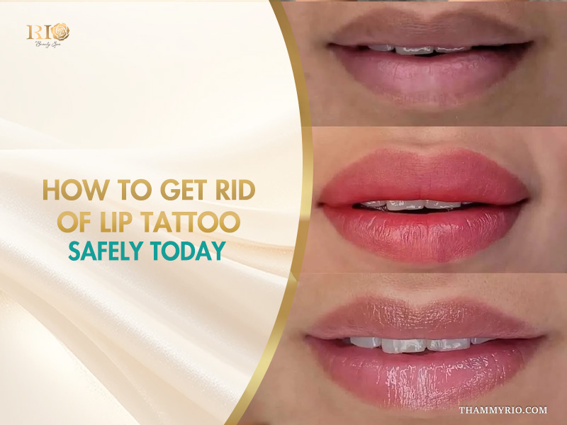 A professional infographic from Rio Beauty Spa showing the steps of how to get rid of lip tattoo safely today with three stages of lip transformation.