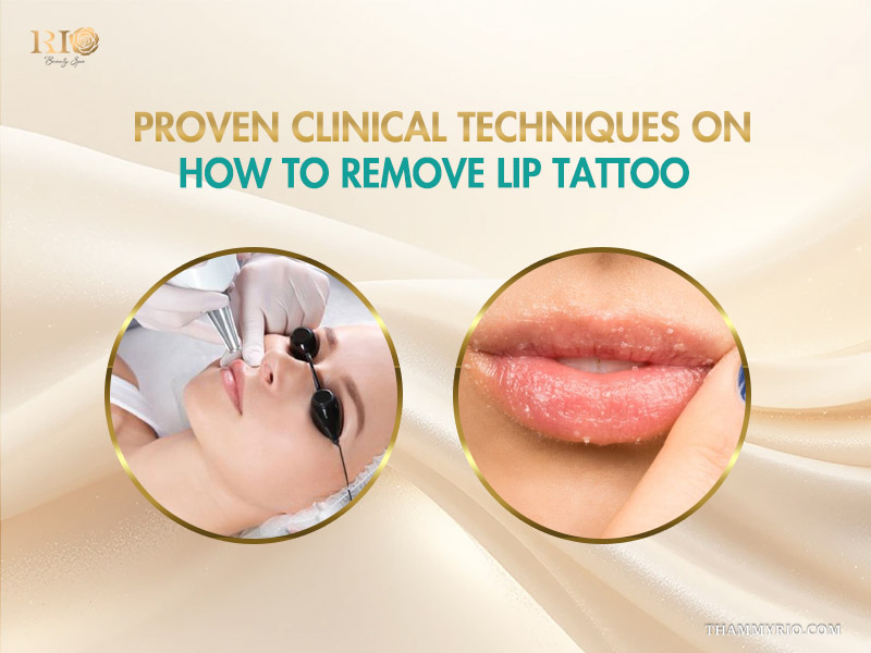 Professional laser treatment and clinical process for how to get rid of lip tattoo.