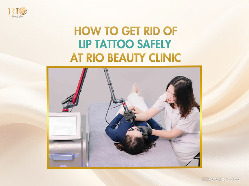 Professional laser lip tattoo removal process at Rio Beauty Clinic.
