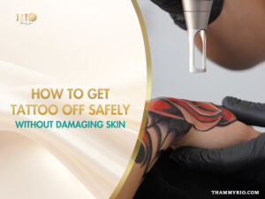 Professional laser treatment to show how to get tattoo off safely without damaging the skin.