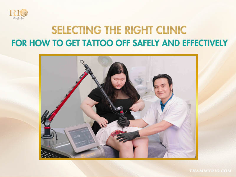 Professional laser tattoo removal at Rio Beauty Clinic showing how to get tattoo off a client's leg safely.