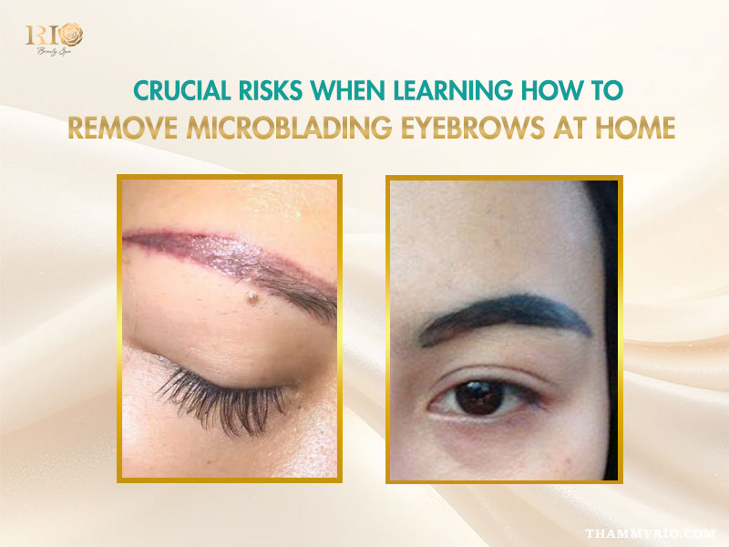 Risks and complications of how to remove microblading at home showing skin irritation and scarring.