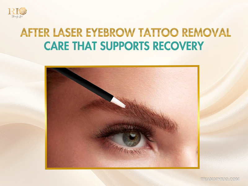 Applying aftercare ointment to support the laser eyebrow tattoo removal healing process and prevent infection.