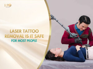 Laser tattoo removal is it safe for most people performed by a professional technician.