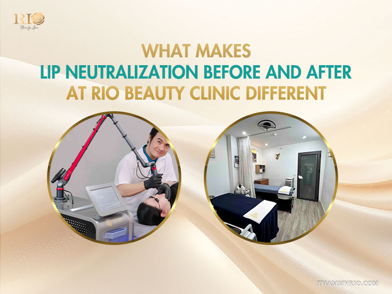 Lip neutralization before and after service at Rio Beauty Clinic featuring advanced laser technology and professional treatment rooms.