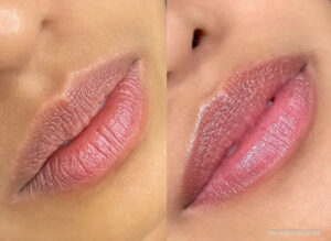 side-by-side comparison of lips before and after a lip neutralization procedure, showcasing the transition from darker tones to a uniform soft pink.