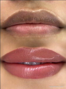 Lip neutralization before and after results showing a transition from dark pigmented lips to a soft rosy terracotta shade.