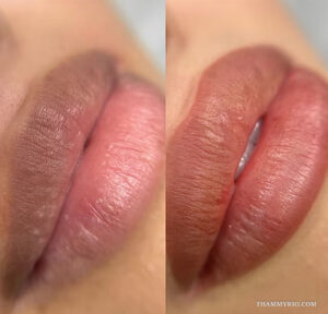 Lip neutralization before and after photo showing the transition from dull, dark lips to a vibrant coral pink tone.