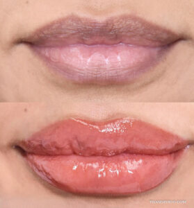 Lip neutralization before and after photo comparing purple-toned dark lips to vibrant glossy reddish-pink lips.