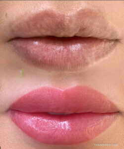 Lip neutralization before and after transformation from pale, uneven lips to a bright and smooth pink shade.