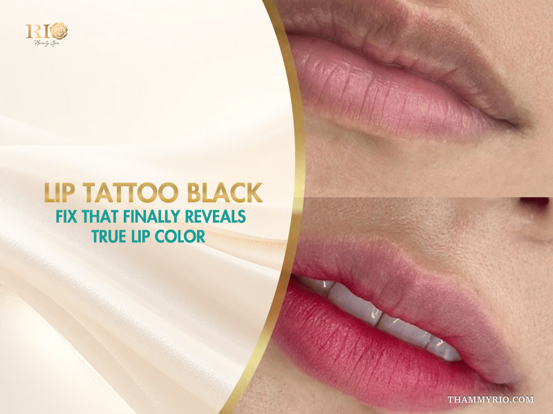 Client before and after lip tattoo black neutralization at Rio Beauty Spa.