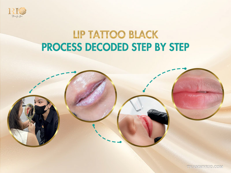Step by step lip tattoo black removal and neutralization process at Rio Beauty Spa.