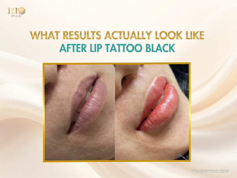 Before and after results of lip tattoo black treatment for dark lips.
