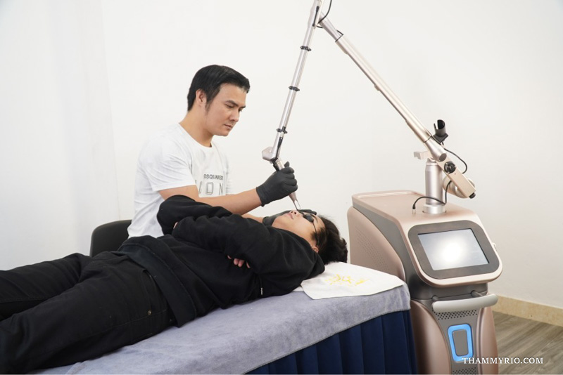 Professional laser technology for microblading correction near me in Hanoi at Rio Beauty Clinic.