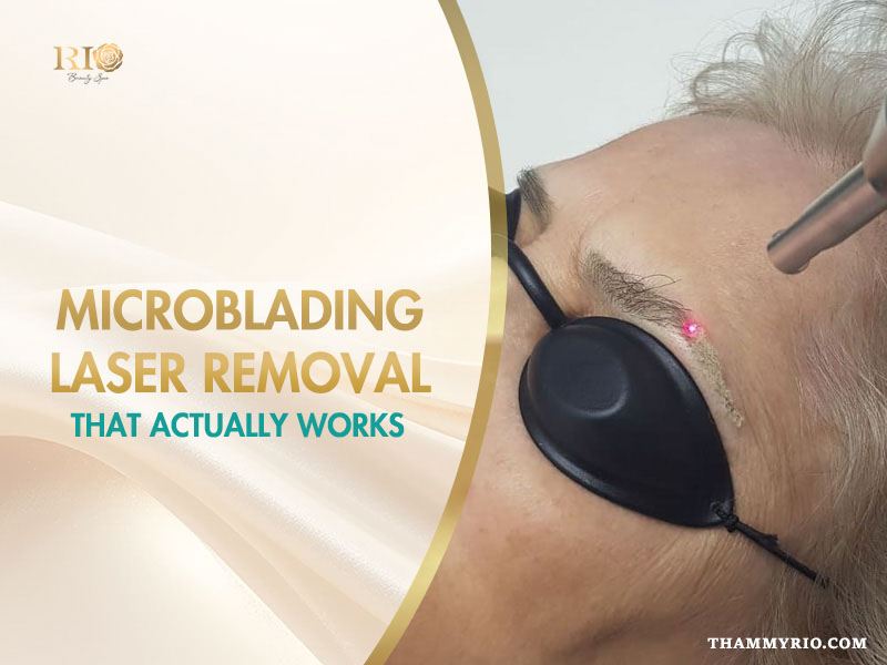 A professional microblading laser removal procedure on a client's eyebrow at Rio Beauty Spa.