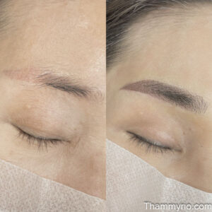 Transformation of damaged eyebrows through microblading laser removal and professional corrective eyebrow tattooing.
