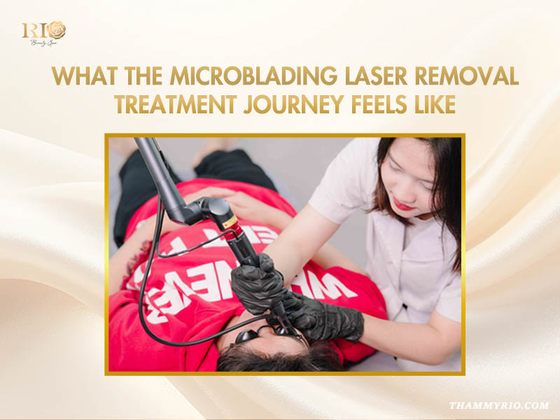 A customer experiencing a comfortable microblading laser removal treatment at Rio Beauty Spa.
