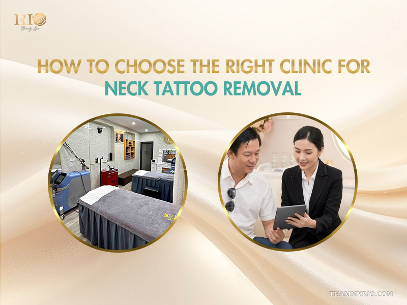 Modern laser clinic room and a professional consultant advising a client about neck tattoo removal.