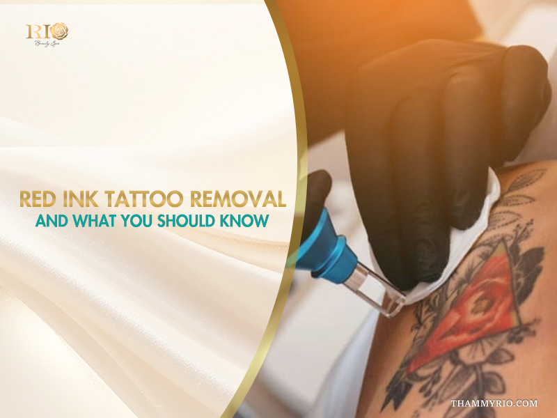 Red ink tattoo removal process using advanced laser technology at Rio Beauty Spa.