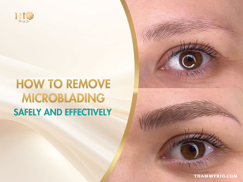 Comparison of eyebrows before and after the removal of microblading process at Rio Beauty Spa.