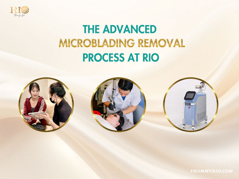 Professional steps for removal of microblading including consultation, laser treatment, and advanced equipment at Rio.
