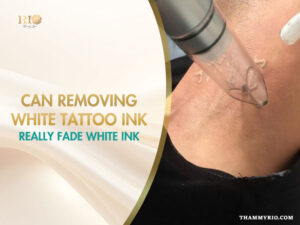 Laser device performing a removing white tattoo ink procedure on a neck tattoo.