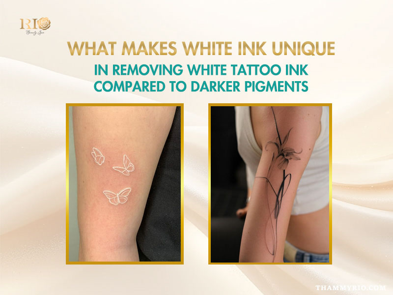 Comparison showing white butterfly tattoos and a dark ink abstract tattoo, highlighting challenges in removing white tattoo ink.