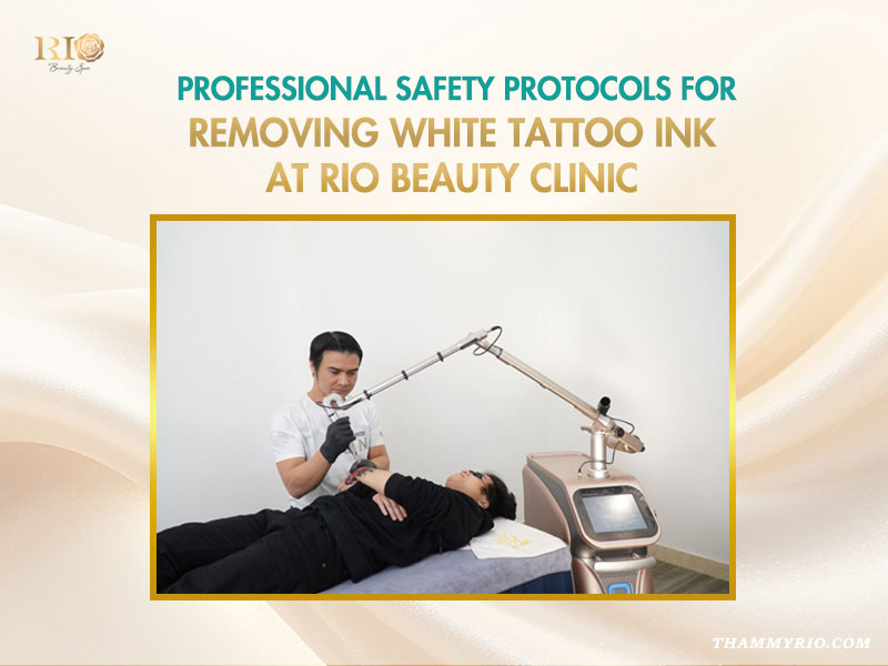 Professional technician using advanced laser technology for removing white tattoo ink at Rio Beauty Clinic.