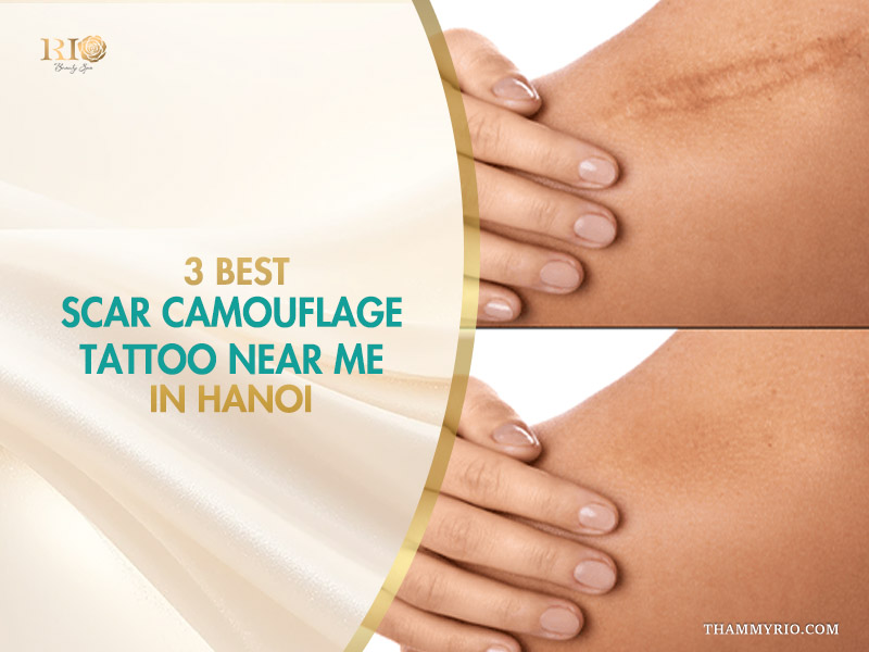 Split-screen image with a hand touching a visible scar and an after shot of scar camouflage tattoo near me in Hanoi.