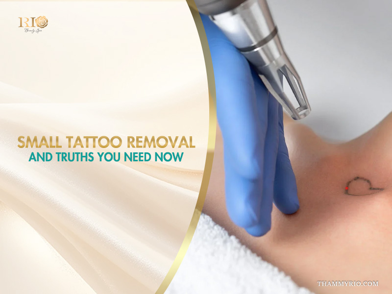 Professional laser device performing small tattoo removal on a heart-shaped wrist tattoo.