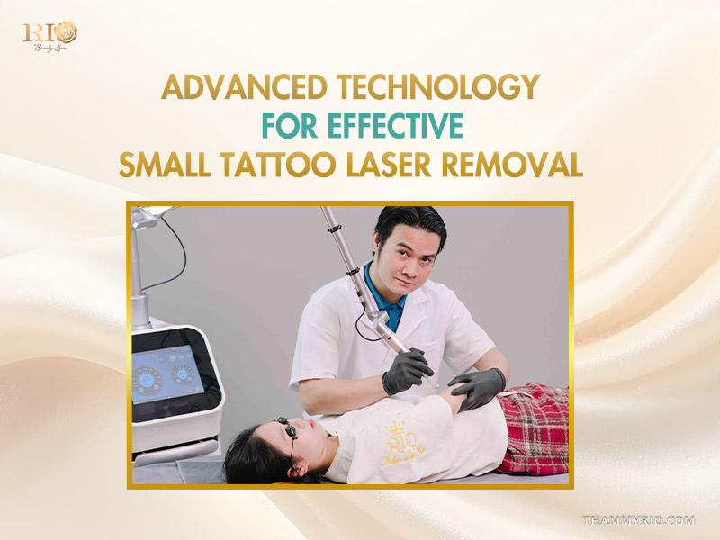 Professional dermatologist using advanced laser technology for small tattoo removal on a patient's arm at Rio Beauty Spa.