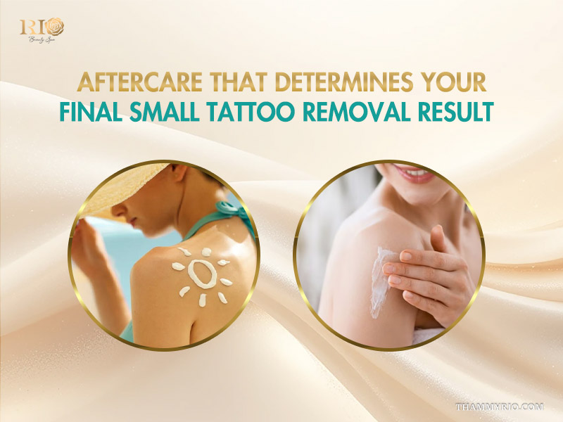 Woman applying sunscreen and healing cream for small tattoo removal aftercare.