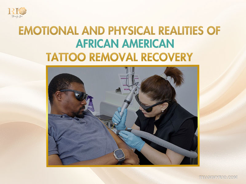 Professional laser tattoo removal black skin procedure performed by an expert at Rio Beauty Spa.