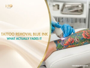 A close-up view of a tattoo removal blue ink treatment on an arm using a laser device by a professional at RIO Beauty Spa.