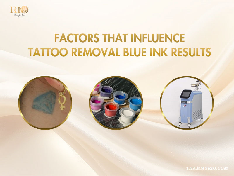 Professional factors affecting tattoo removal blue ink results including laser technology and ink composition.