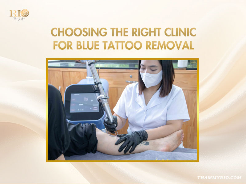 Professional clinic specialist performing precise laser therapy for tattoo removal blue ink on a patient's lower leg.