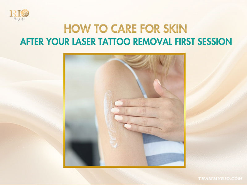 Woman applying healing cream to her arm after a laser tattoo removal first session.
