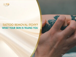 Person scratching a tattoo during the tattoo removal itchy phase.