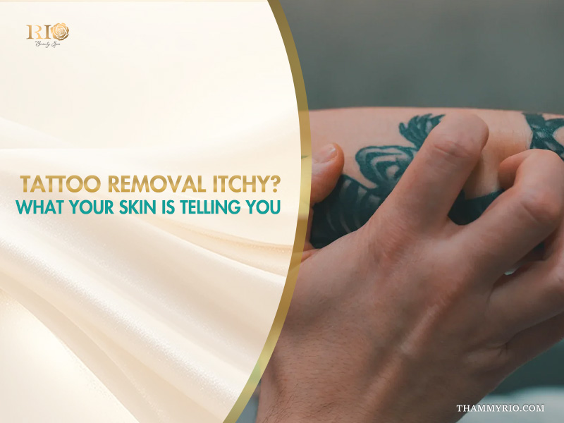 Person scratching a tattoo during the tattoo removal itchy phase.